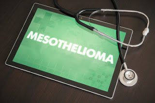 Mesothelioma-causes-Symptoms-Treatment  Mesothelioma-causes-Symptoms-Treatment