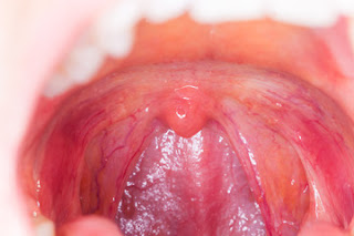 tonsils function of tonsils