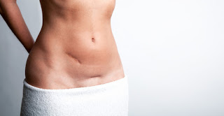 Scar How to remove scar Naturally