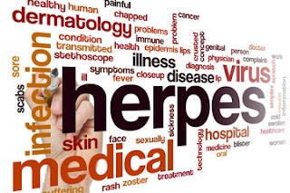 What-you-need-to-know-about-herpes What-you-need-to-know-about-herpes