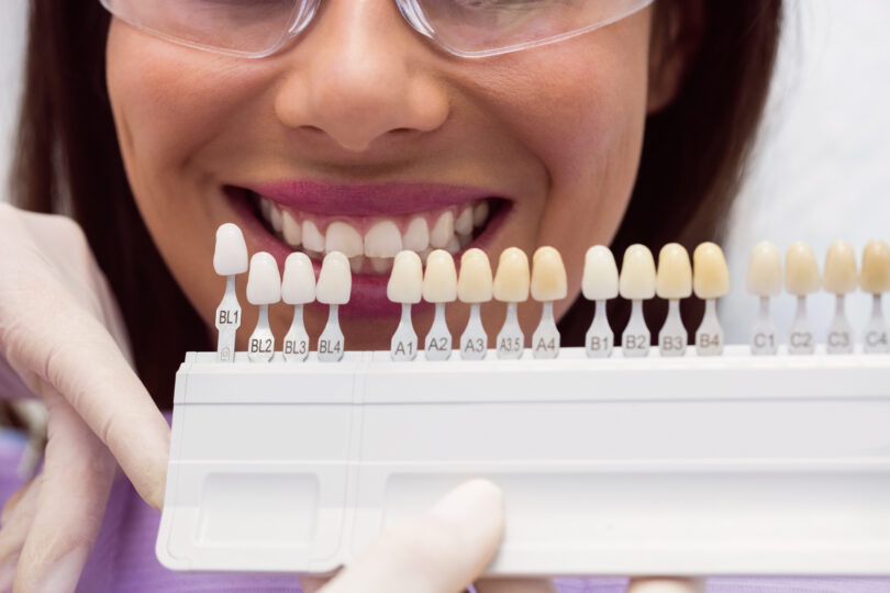 Core Benefits of Veneers Dentist examining female patient with teeth shades at dental clinic