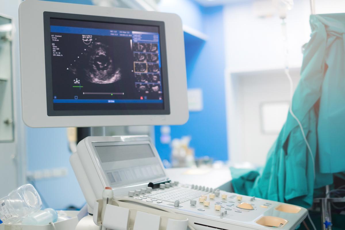 Echocardiogram | OSF Saint Elizabeth Medical Center